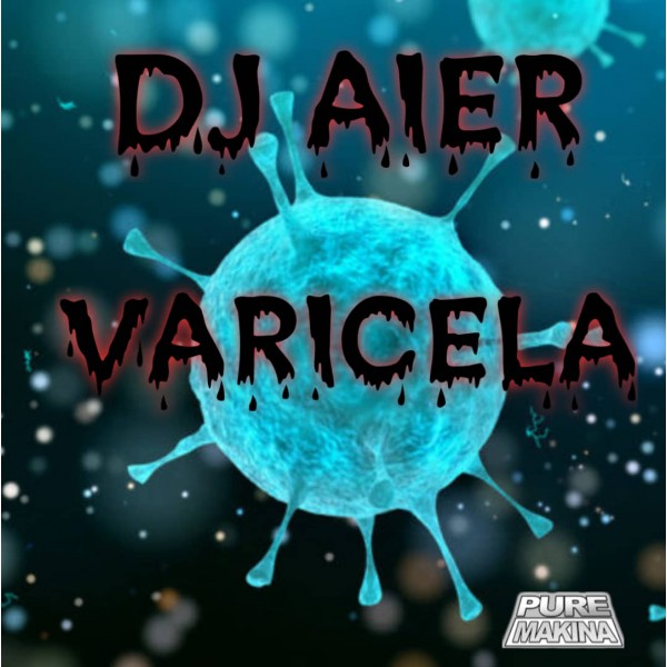 Varicela