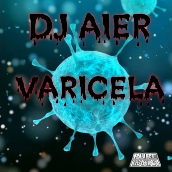 Varicela